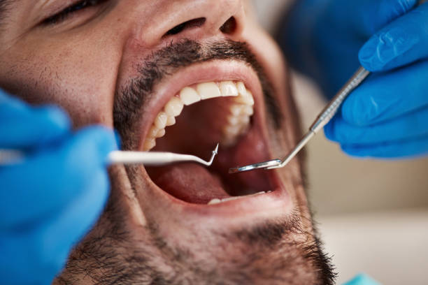 Best Emergency Dental Care for Broken or Chipped Teeth in Cataula, GA